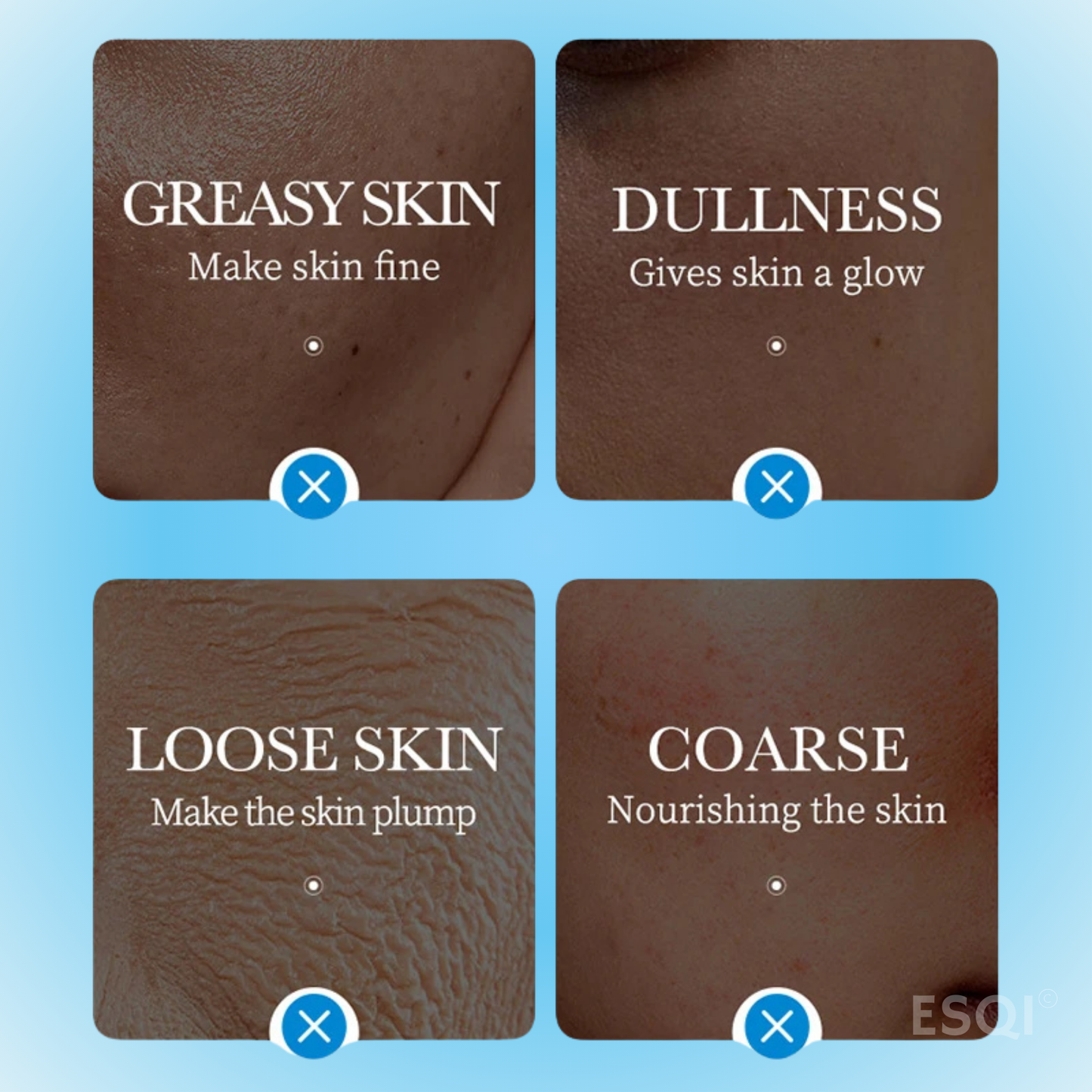 5 X Ice Mask for Moisturizing & Skin Revitalization